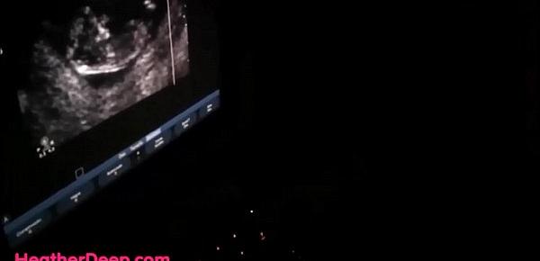  HD 12 Weeks Pregnant Heather Deep Thai Teen gets facial after ultrasound